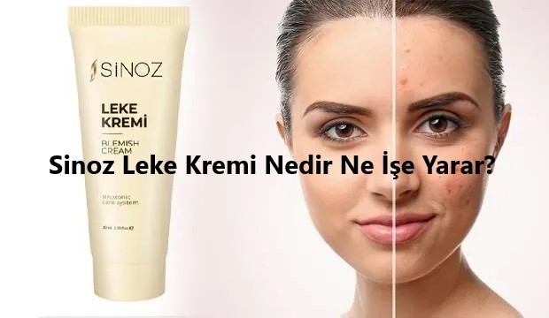 Sinoz Leke Kremi Nedir Ne İşe Yarar
