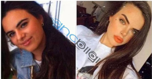 Instagram Berika Demir Estetiksiz Hali