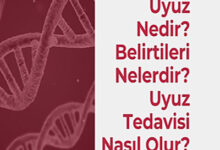 Uyuz Nedir Belirtileri Nelerdir Uyuz Tedavisi Nasil Olur
