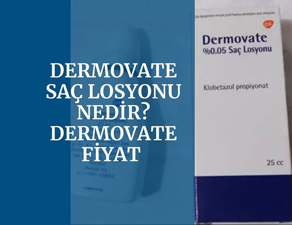 Dermovate Sac Losyonu Nedir