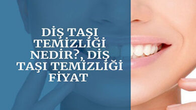 Dis Tasi Temizligi Nedir Dis Tasi Temizligi Fiyat