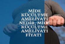 Mide Kucultme Ameliyati Fiyati