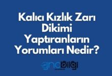 Kalici Kizlik Zari Dikimi Yaptiranlarin Yorumlari