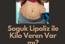 Soguk Lipoliz Yaptiranlarin Yorumlari