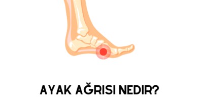 Ayak Ağrısı Nedir