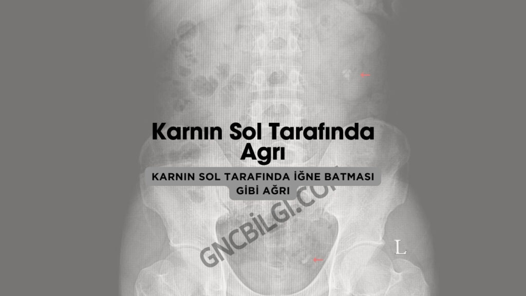 Karnin Sol Tarafinda igne Batmasi Gibi Agri