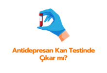 Antidepresan Kan Testinde cikar mi