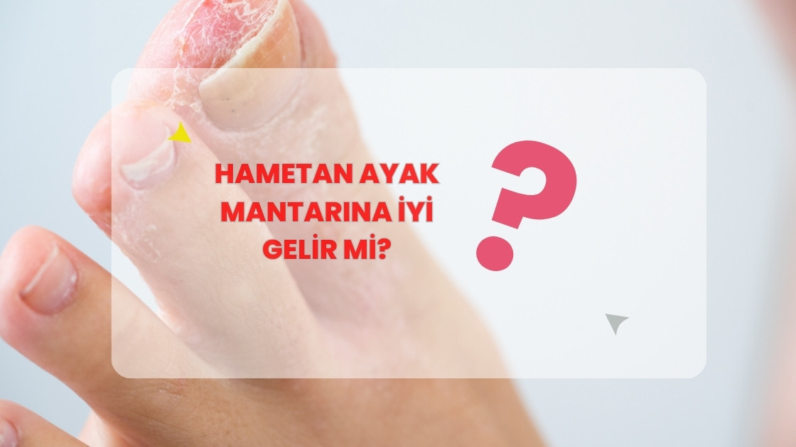 Hametan Ayak Mantarina İyi Gelir mi
